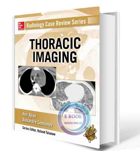 دانلود کتاب Radiology Case Review Series: Thoracic Imaging 1st (ORIGINAL PDF)